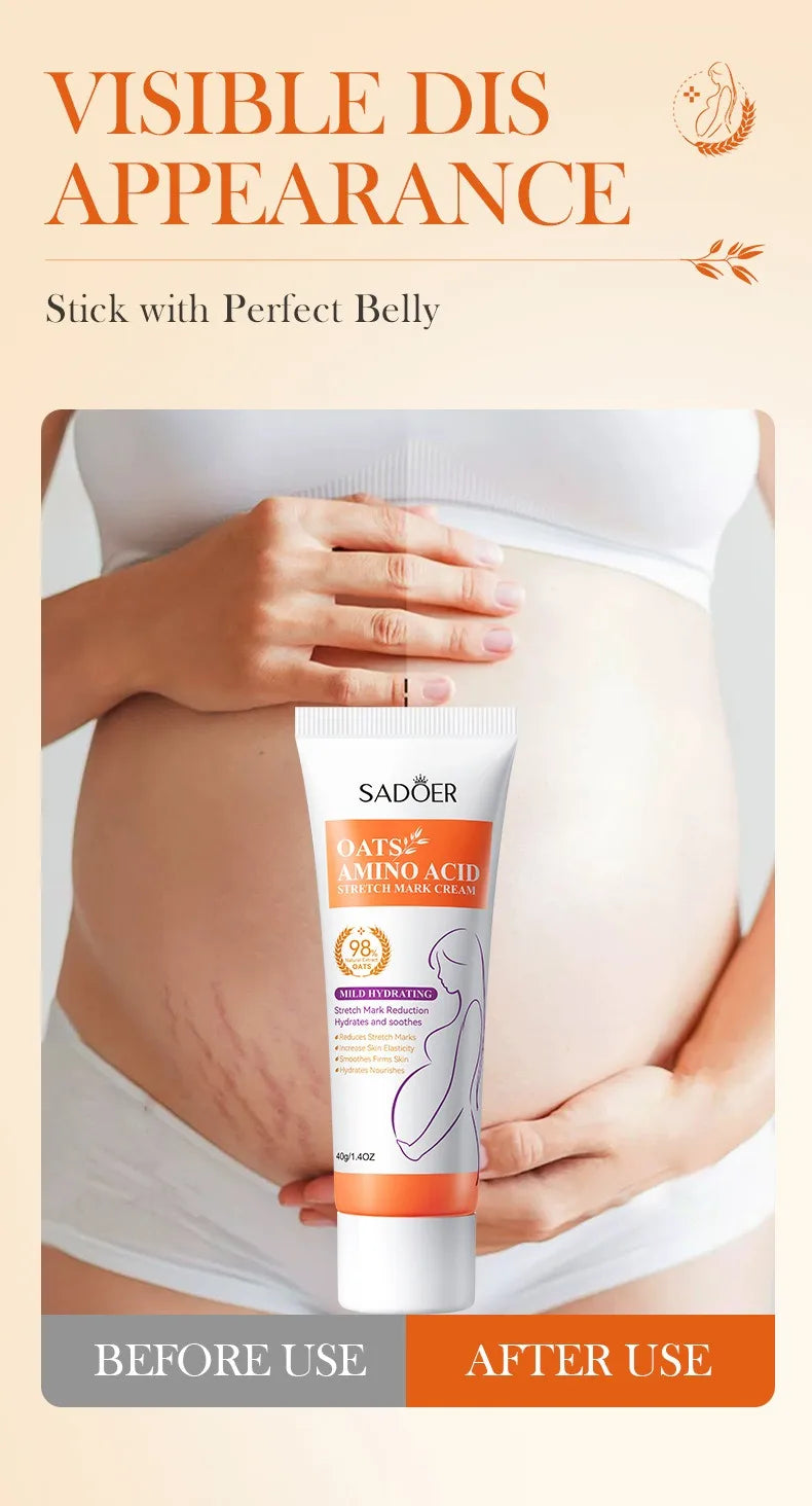 Removes Stretch Mark Cream To Remove Postpartum Obesity Pregnant Women Repair Anti-Aging Winkles Firming Body Cream Skin Care