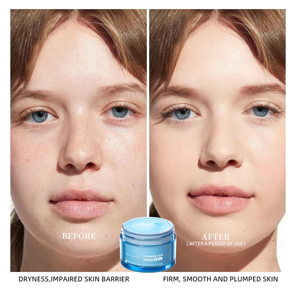 Hyaluronic Acid Hydrating Water Gel/Moisturizing Facial Cream Daily Face Moisturizer for Dry Skin Improve Dryness 50g