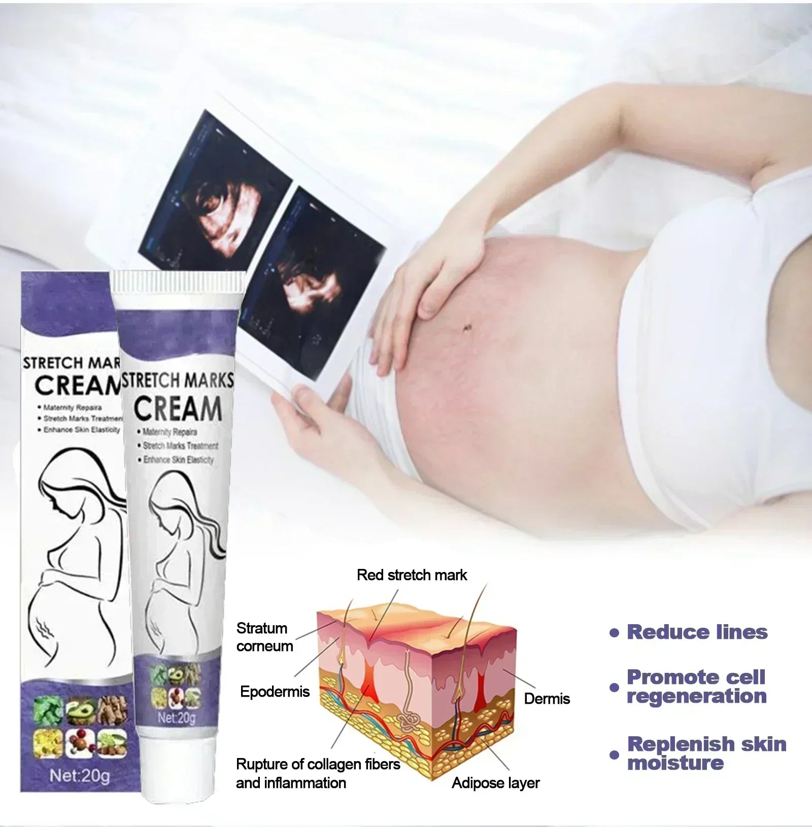 Stretch Mark Removal Cream Permanently Removes Stretch Marks Rejuvenates Skin Stretch Mark Removal Cream