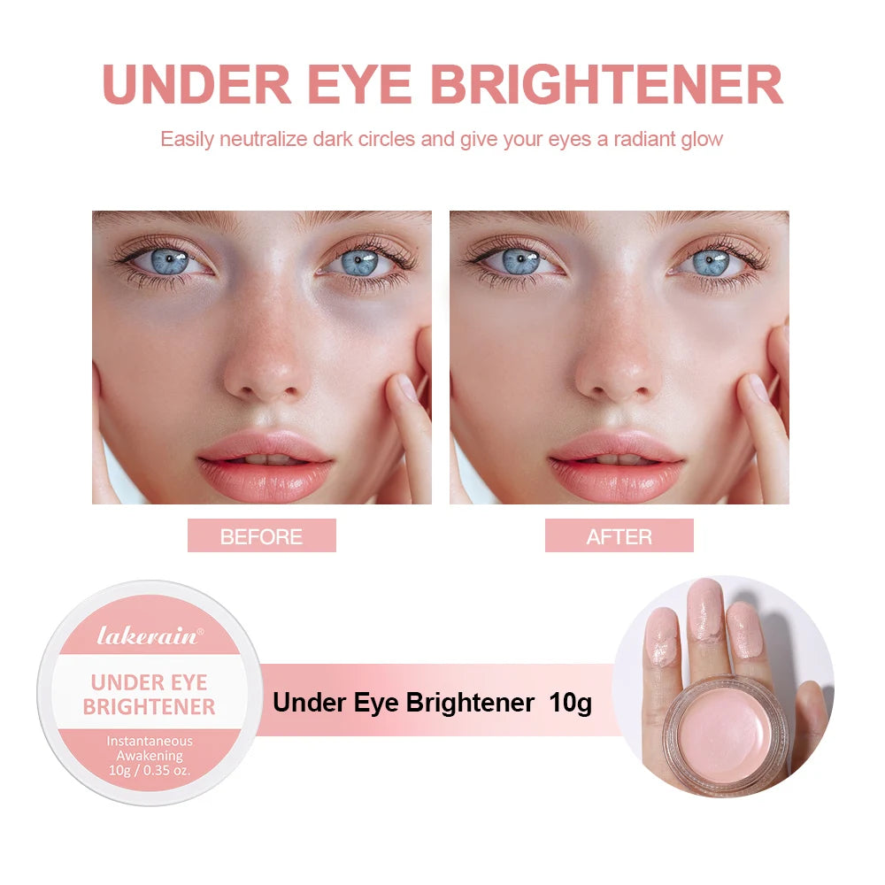 Eye Cream, Eye Concealer, Moisturizes the Skin Around the Eyes