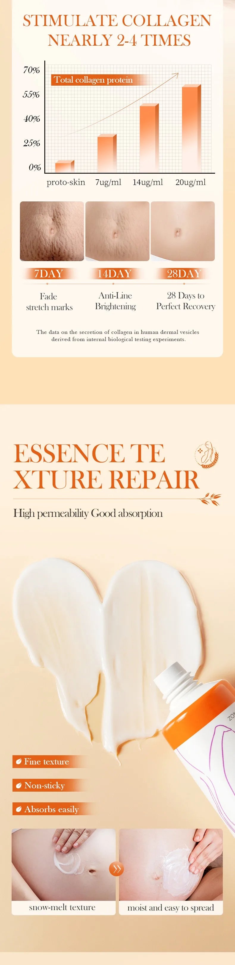 Removes Stretch Mark Cream To Remove Postpartum Obesity Pregnant Women Repair Anti-Aging Winkles Firming Body Cream Skin Care