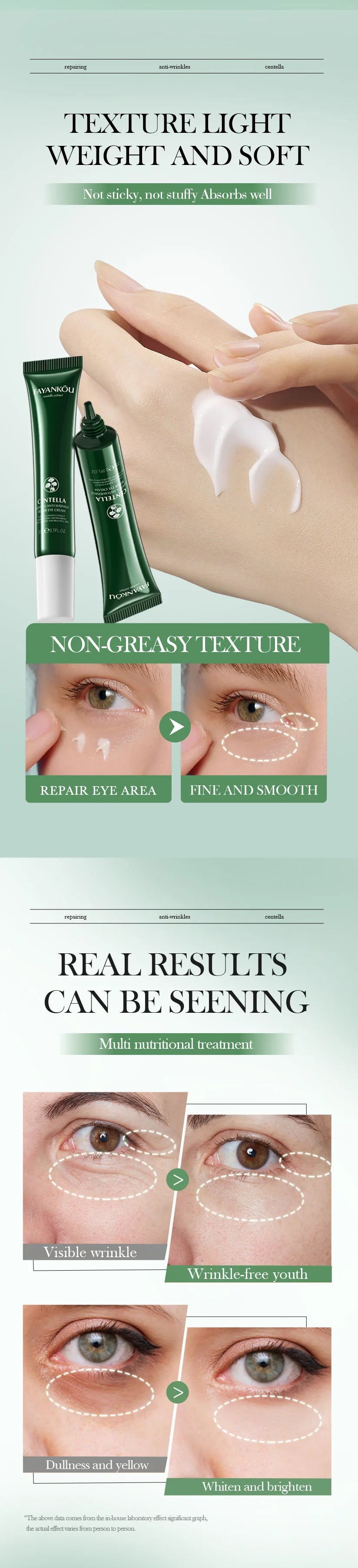 Centella Asiatica Eye Cream Anti Dark Circles Under the Eyes Remove Eye Bags Moisturizing Eyes Skin Care Products